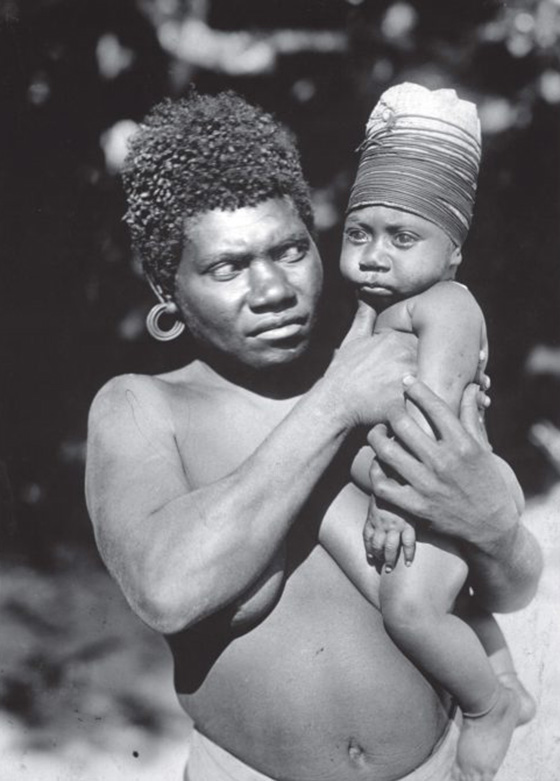 Allungamento del cranio (dolicocefalia) praticata nell Isole Vanuatu
